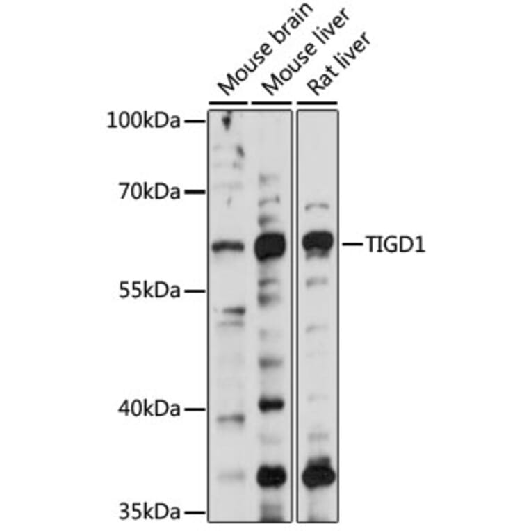 Western Blot - Anti-TIGD1 Antibody (A90880) - Antibodies.com