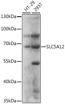 Western blot analysis of extracts of various cell lines, using Anti-SLC5A12 Antibody (A16177) at 1:1,000 dilution.
Secondary antibody: Goat Anti-Rabbit IgG (H+L) (HRP) (AS014) at 1:10,000 dilution.
Lysates / proteins: 25µg per lane.
Blocking buffer: 3% non-fat dry milk in TBST.
Detection: ECL Basic Kit (RM00020).
Exposure time: 5s.