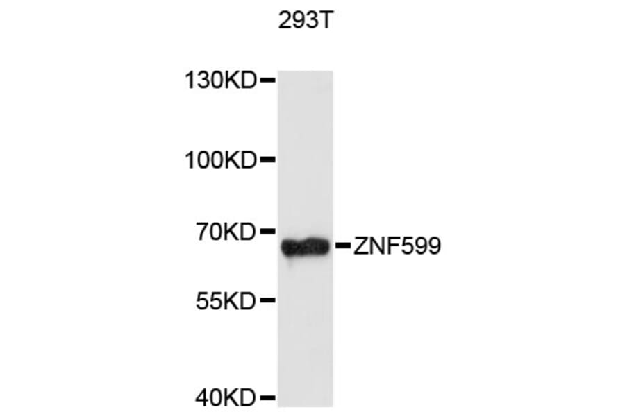 Western Blot - Anti-ZNF599 Antibody (A13140) - Antibodies.com