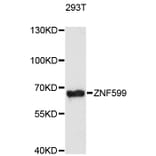 Western Blot - Anti-ZNF599 Antibody (A13140) - Antibodies.com