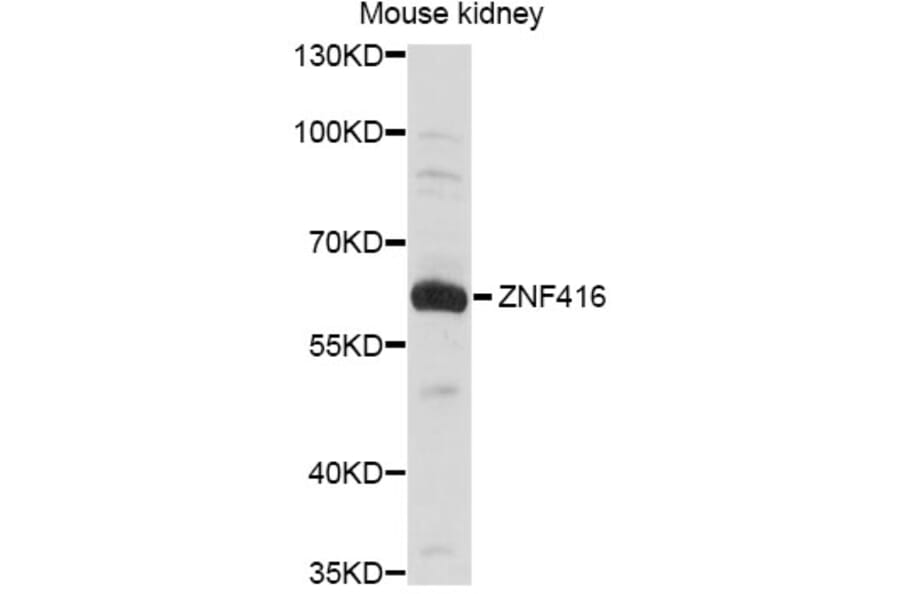 Western Blot - Anti-ZNF416 Antibody (A14411) - Antibodies.com