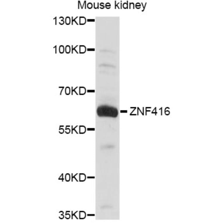 Western Blot - Anti-ZNF416 Antibody (A14411) - Antibodies.com