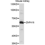 Western Blot - Anti-ZNF416 Antibody (A14411) - Antibodies.com