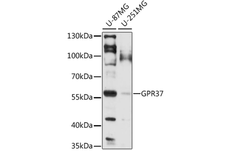 Western Blot - Anti-GPCR GPR37 Antibody (A90885) - Antibodies.com