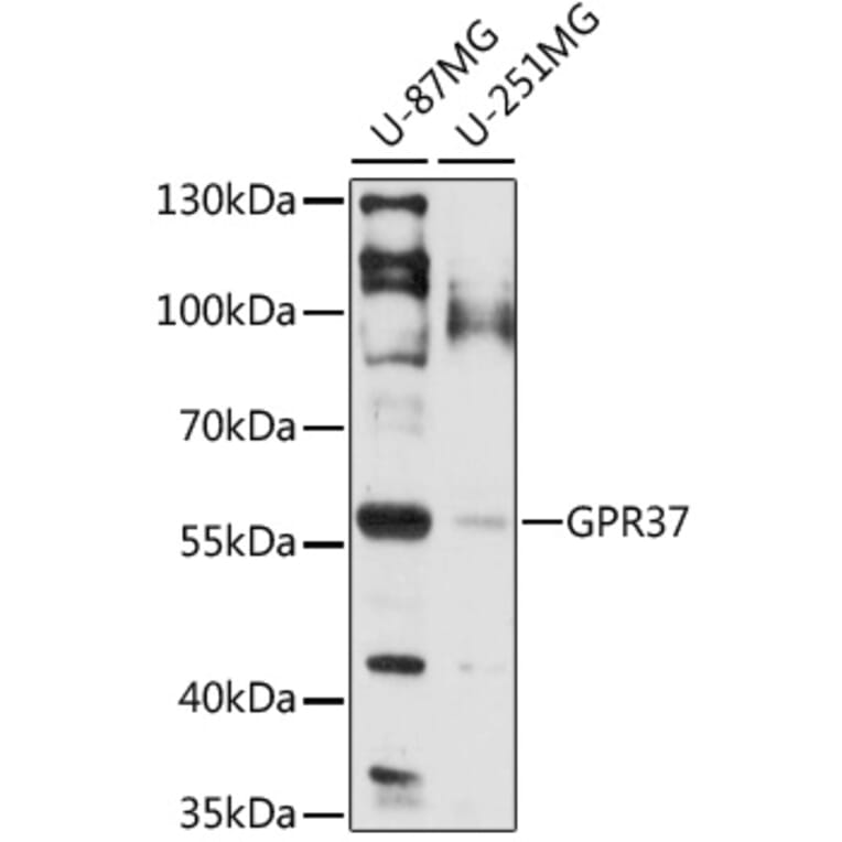 Western Blot - Anti-GPCR GPR37 Antibody (A90885) - Antibodies.com