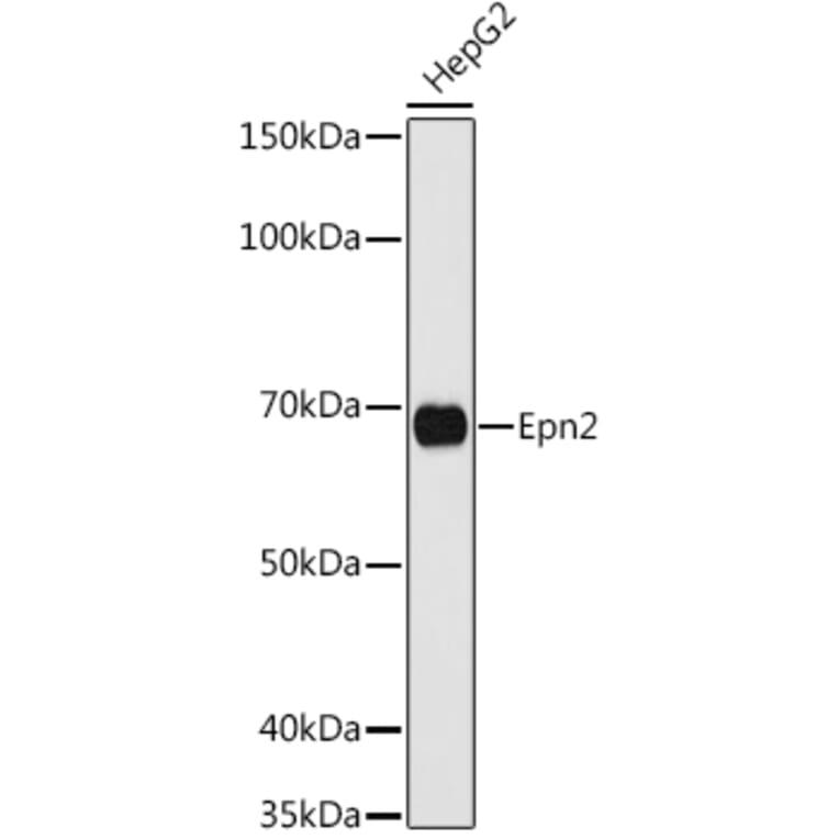 Western Blot - Anti-Epsin 2 Antibody (A90886) - Antibodies.com