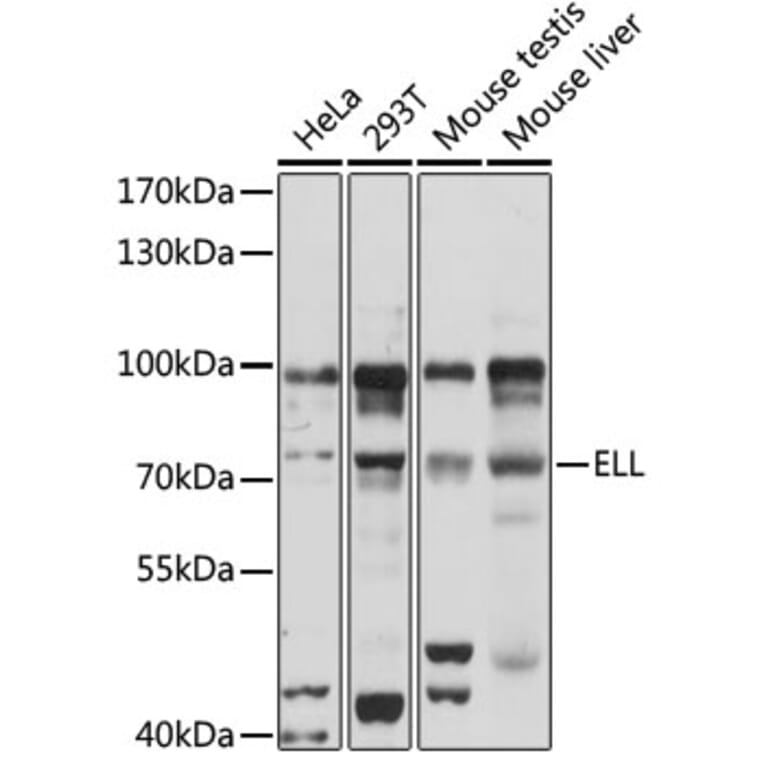 Western Blot - Anti-ELL Antibody (A90887) - Antibodies.com