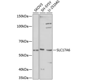 Western Blot - Anti-VGLUT2 Antibody (A90888) - Antibodies.com