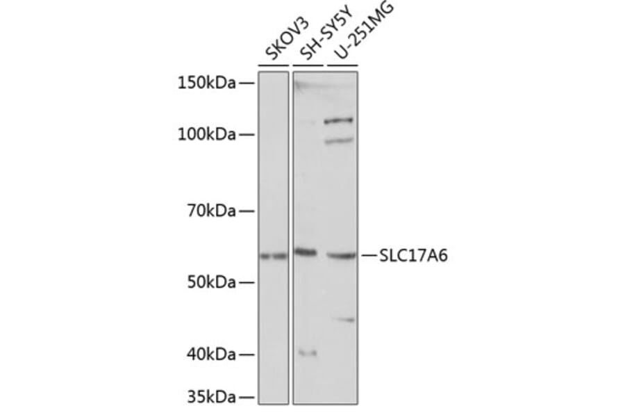 Western Blot - Anti-VGLUT2 Antibody (A90888) - Antibodies.com