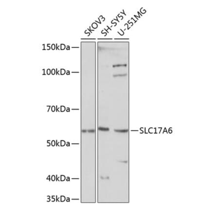 Western Blot - Anti-VGLUT2 Antibody (A90888) - Antibodies.com