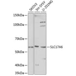 Western Blot - Anti-VGLUT2 Antibody (A90888) - Antibodies.com