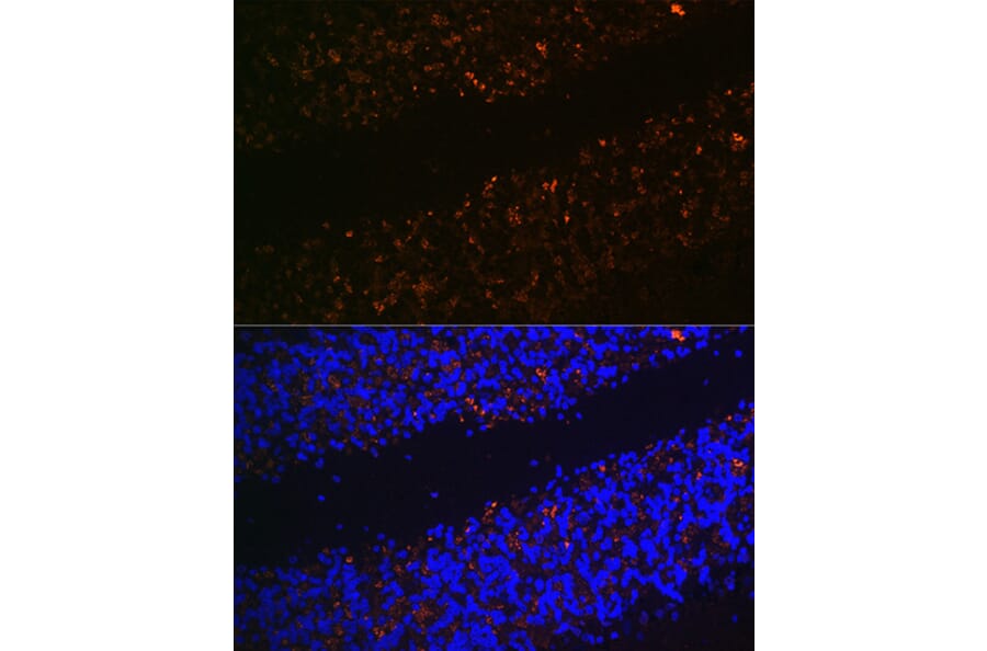 Immunofluorescence - Anti-VGLUT2 Antibody (A90888) - Antibodies.com