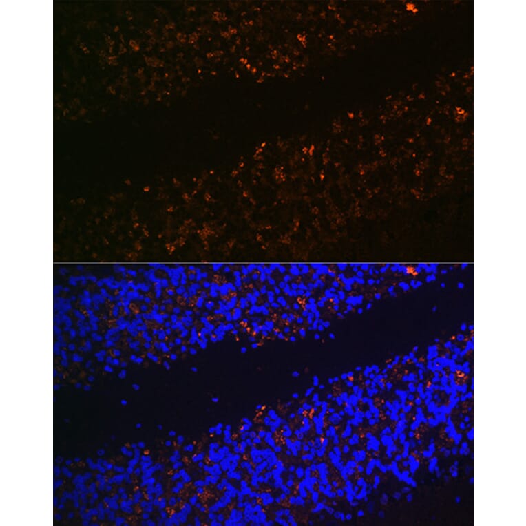 Immunofluorescence - Anti-VGLUT2 Antibody (A90888) - Antibodies.com