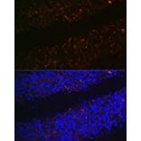 Immunofluorescence - Anti-VGLUT2 Antibody (A90888) - Antibodies.com