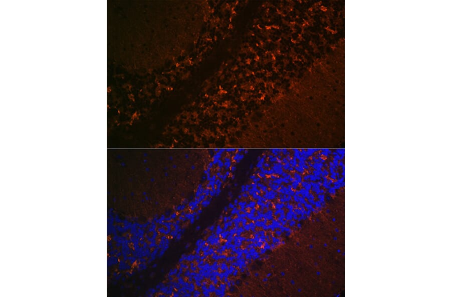 Immunofluorescence - Anti-VGLUT2 Antibody (A90888) - Antibodies.com