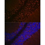 Immunofluorescence - Anti-VGLUT2 Antibody (A90888) - Antibodies.com