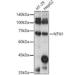 Western Blot - Anti-Netrin 1 Antibody (A90889) - Antibodies.com