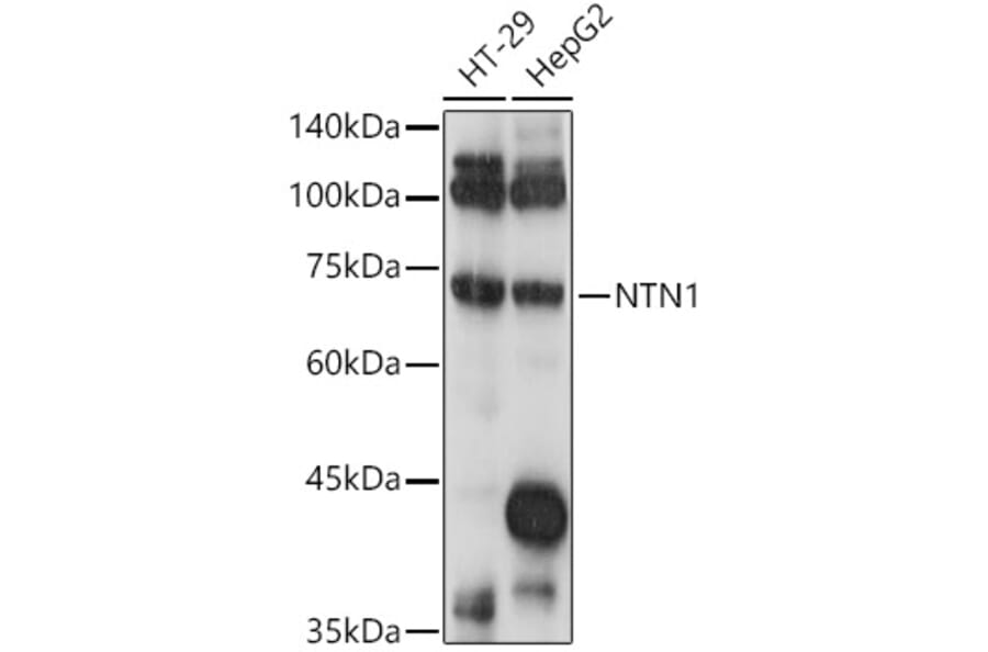 Western Blot - Anti-Netrin 1 Antibody (A90889) - Antibodies.com