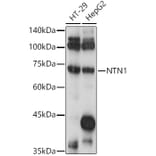 Western Blot - Anti-Netrin 1 Antibody (A90889) - Antibodies.com