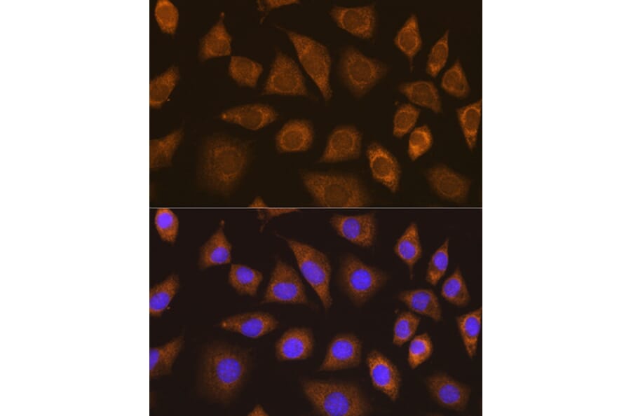 Immunofluorescence - Anti-TRIM25/EFP Antibody (A90890) - Antibodies.com