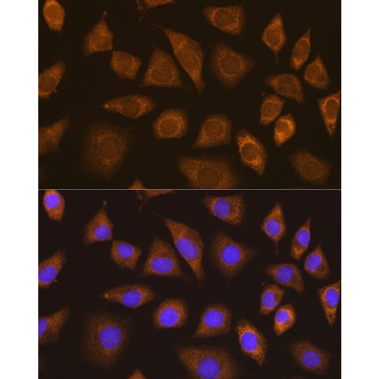 Immunofluorescence - Anti-TRIM25/EFP Antibody (A90890) - Antibodies.com