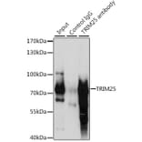 Western Blot - Anti-TRIM25/EFP Antibody (A90890) - Antibodies.com