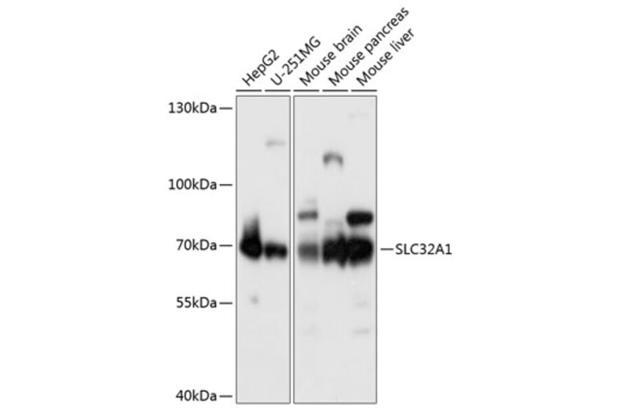 Western Blot - Anti-SLC32A1/VGAT Antibody (A90891) - Antibodies.com