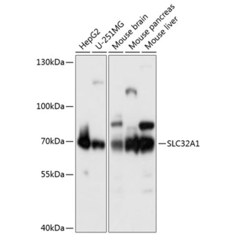 Western Blot - Anti-SLC32A1/VGAT Antibody (A90891) - Antibodies.com