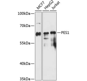 Western Blot - Anti-Pescadillo Antibody (A90892) - Antibodies.com