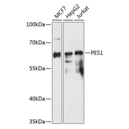 Western Blot - Anti-Pescadillo Antibody (A90892) - Antibodies.com