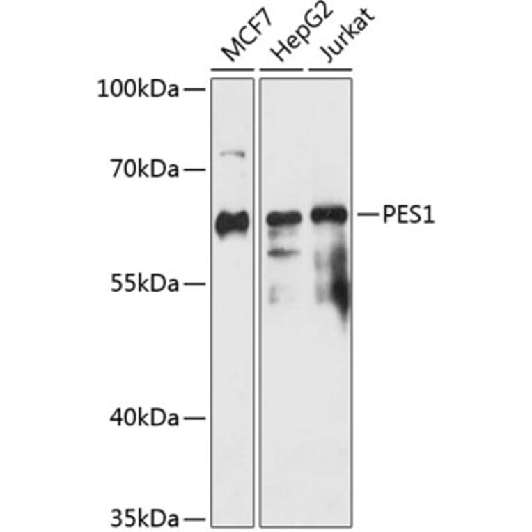 Western Blot - Anti-Pescadillo Antibody (A90892) - Antibodies.com