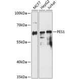 Western Blot - Anti-Pescadillo Antibody (A90892) - Antibodies.com