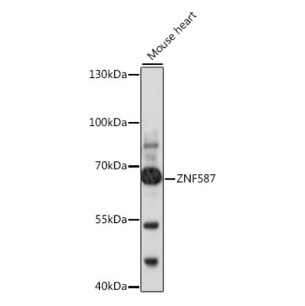 Western Blot - Anti-ZNF587 Antibody (A90893) - Antibodies.com