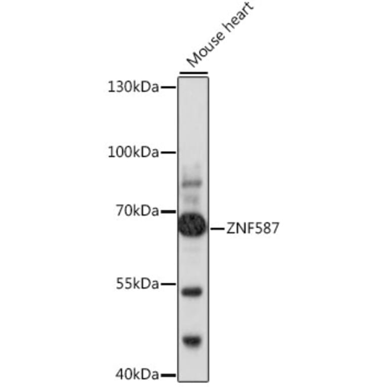 Western Blot - Anti-ZNF587 Antibody (A90893) - Antibodies.com