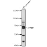 Western Blot - Anti-ZNF587 Antibody (A90893) - Antibodies.com