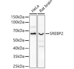 Western Blot - Anti-SREBP2 Antibody (A90894) - Antibodies.com