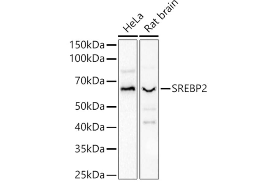 Western Blot - Anti-SREBP2 Antibody (A90894) - Antibodies.com