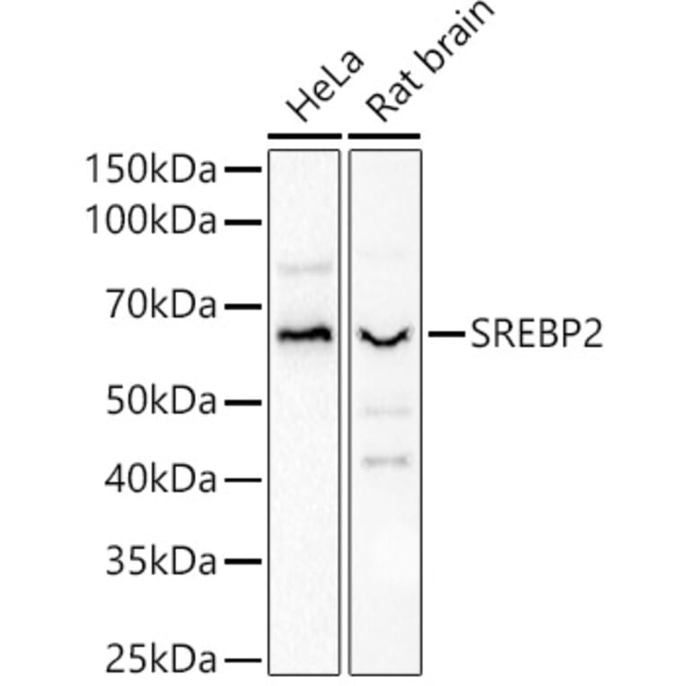 Western Blot - Anti-SREBP2 Antibody (A90894) - Antibodies.com