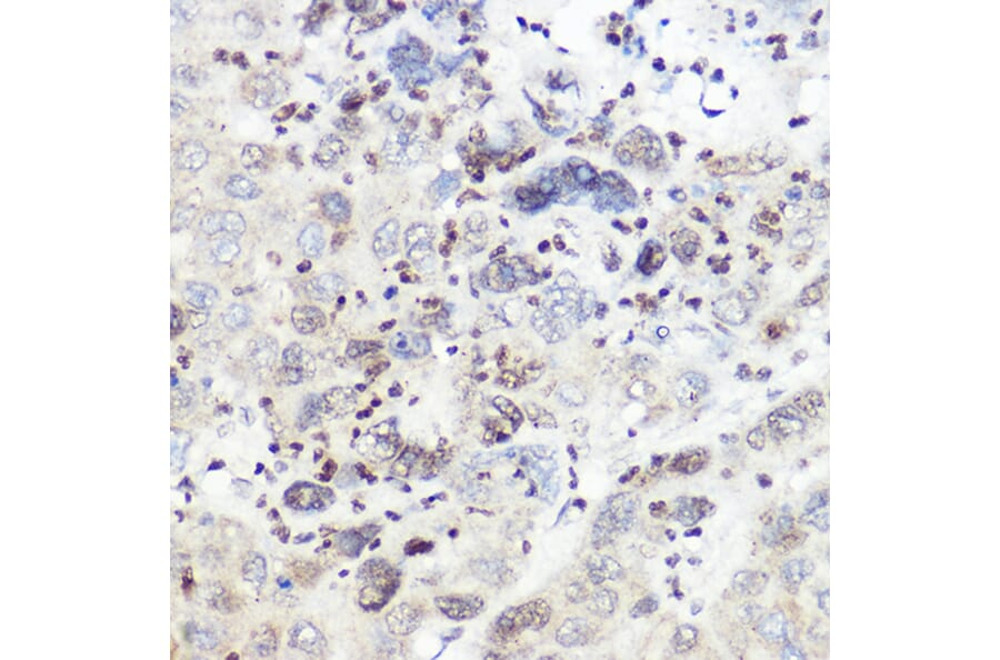 Immunohistochemistry - Anti-SREBP2 Antibody (A90894) - Antibodies.com