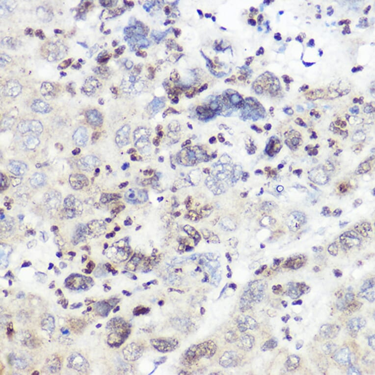 Immunohistochemistry - Anti-SREBP2 Antibody (A90894) - Antibodies.com