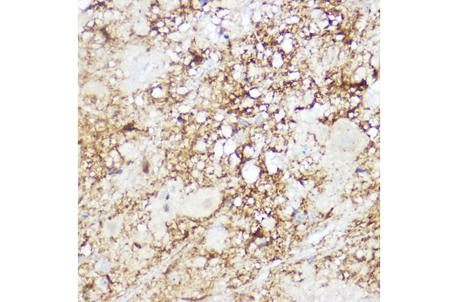 Immunohistochemistry - Anti-SREBP2 Antibody (A90894) - Antibodies.com