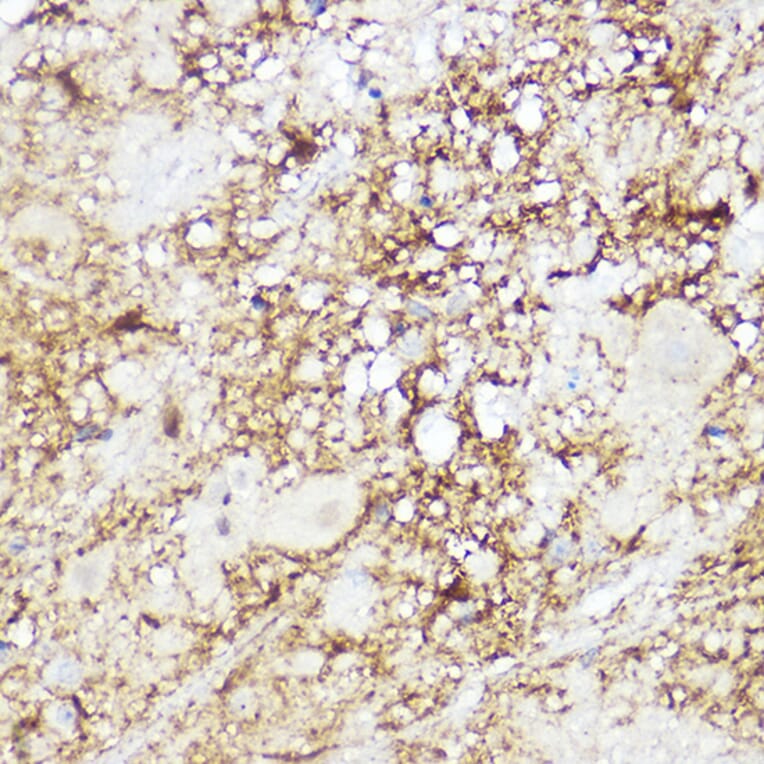Immunohistochemistry - Anti-SREBP2 Antibody (A90894) - Antibodies.com