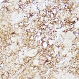 Immunohistochemistry - Anti-SREBP2 Antibody (A90894) - Antibodies.com