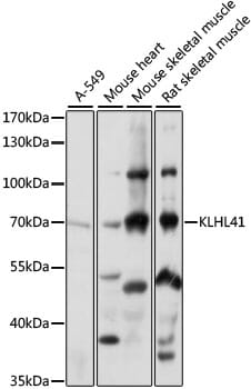 Western blot analysis of extracts of various cell lines, using Anti-KLHL41 Antibody (A15383) at 1:1,000 dilution.
Secondary antibody: Goat Anti-Rabbit IgG (H+L) (HRP) (AS014) at 1:10,000 dilution.
Lysates / proteins: 25µg per lane.
Blocking buffer: 3% non-fat dry milk in TBST.
Detection: ECL Basic Kit (RM00020).
Exposure time: 1s.