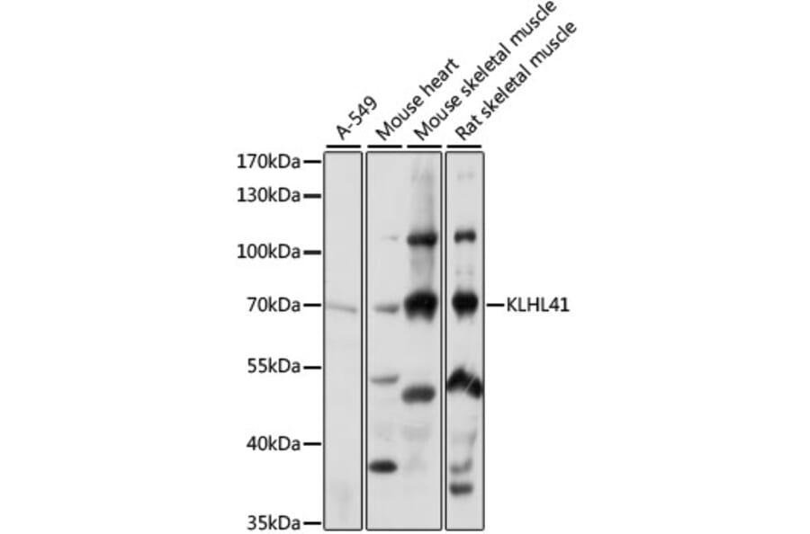 Western Blot - Anti-KBTBD10/KRP1 Antibody (A90895) - Antibodies.com
