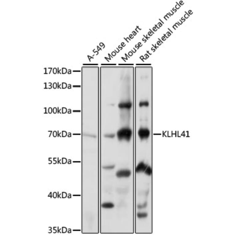 Western Blot - Anti-KBTBD10/KRP1 Antibody (A90895) - Antibodies.com