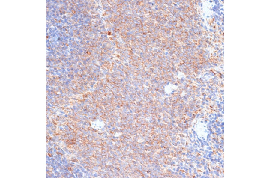 Immunohistochemistry - Anti-G3BP Antibody (A90896) - Antibodies.com