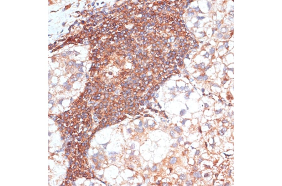 Immunohistochemistry - Anti-G3BP Antibody (A90896) - Antibodies.com