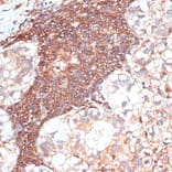 Immunohistochemistry - Anti-G3BP Antibody (A90896) - Antibodies.com