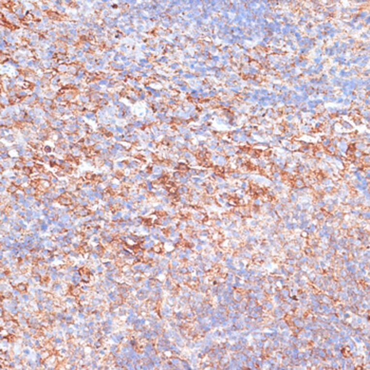 Immunohistochemistry - Anti-G3BP Antibody (A90896) - Antibodies.com